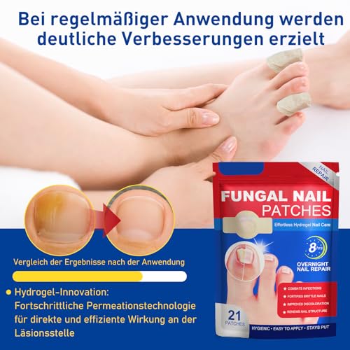 21 Stück Pilz Nagel Patches Nagelpilzpflaster Zehennagel Korrektur Patch Mehrzweck Pads Zehennagel Patches für Beschädigte Nägel und das Erscheinungsbild Verfärbter Nägel (3 Packung)