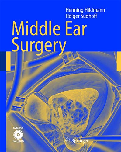 Preisvergleich Produktbild Middle Ear Surgery