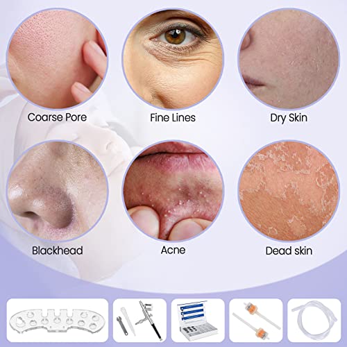 2 In 1 Professional Facial Microderm Machine With Touch Screen，Mcwdoit Skin Care Beauty Device With Spray Kit，68Cmhg Strong Suction Power #TOP2