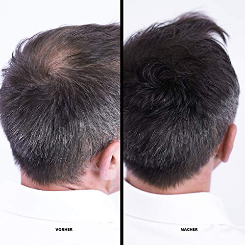 Streuhaar Super Million Hair Haarfasern für volles Haar