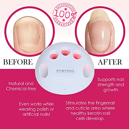 Stimunail - Nail Wellness Device - Supports Grow Long Strong Nails - Gentle Heat, Red Led Light & Vibrating Massage Promote Healthy Growth - Support Weak & Brittle Nails - Usb Rechargeable Device #TOP2