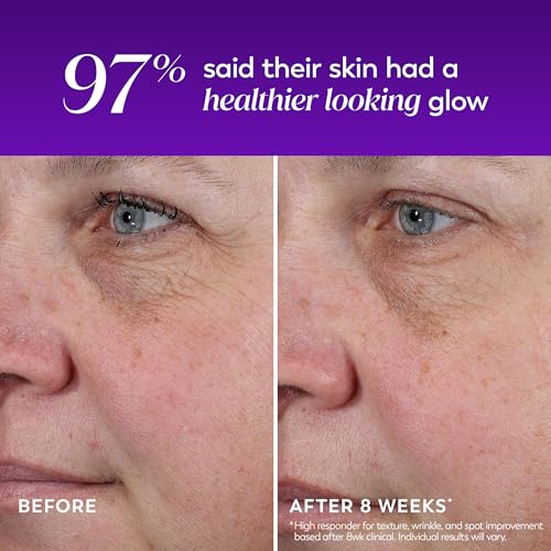 Image of Olay Regenerist Chemical Peel for Face, Overnight Face Peel Mask, Anti-Aging Skin Care, Night Serum, For Fine Lines & Dark Spots, Fragrance-Free, Hexa-Repair Peptide & Lactic Acid, 1.0oz