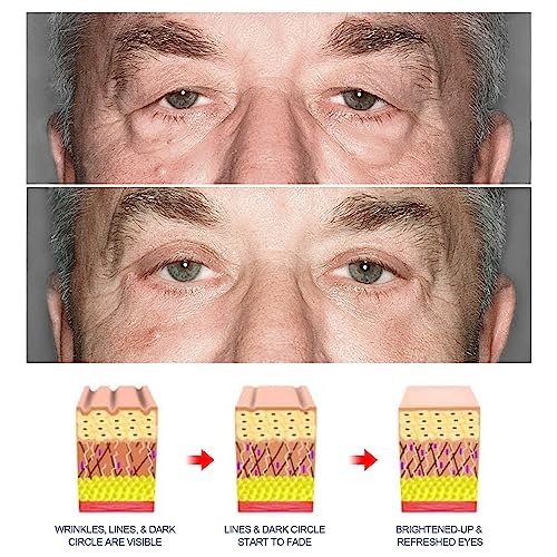 Mikabila Crema Occhiaie Uomo Naturale,Contorno
