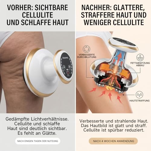 4-in-1 Massagegerät Gegen Cellulite - Vakuum & Gua Sha Elektrisch, Cellulite Massagegerät, Schröpfgerät Elektrisch, Vakuum-Wärme-Gua Sha 6 Stufen Straffere Haut mit Wärme Ganzkörper Anwendung Zuhause