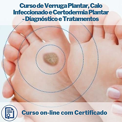 Curso on-line de Verruga Plantar, Calo Infeccionado e Certodermia Plantar - Diagnóstico e Tratamento