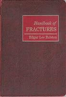 Handbook of Fractures B0000CO5QE Book Cover