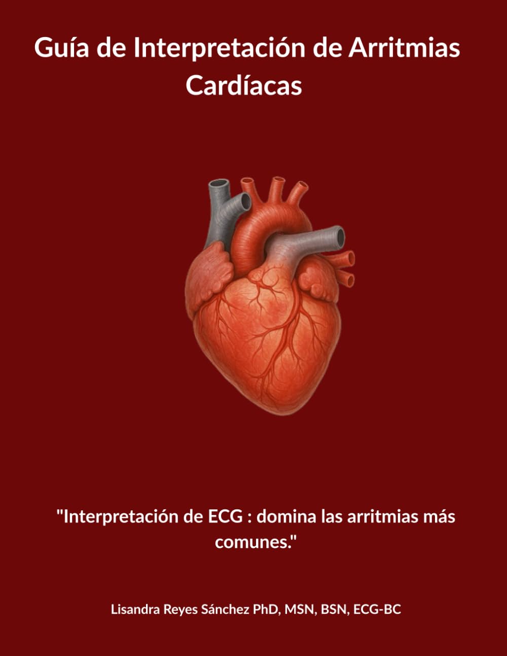 Guía de Interpretación de Arritmias Cardíacas: "Interpretación de ECG : domina las arritmias más comunes."