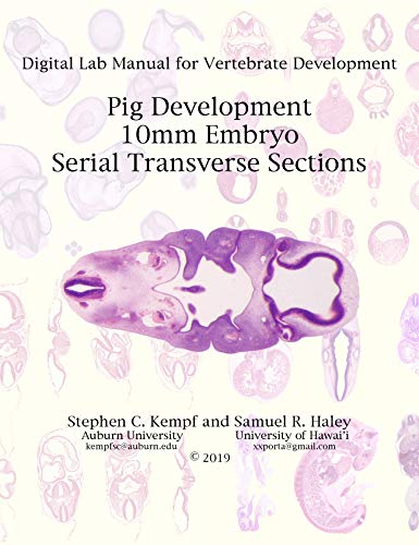10mm Pig Embryo Serial Transverse Sections: Digital Lab Manual for Vertebrate Development