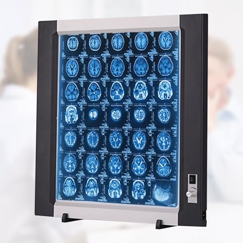 Lampe de Visualisation Radiologique Portable à LED, Boîte Lumineuse D'Illuminateur de Film à Rayons X à Luminosité Réglable for Hôpitaux, Cliniques, Cabinets Médicaux et Laboratoires