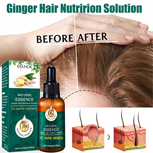 Natural Essence Ginger Hair Nutrition Solution, Hair Regrowth Serum Hair Loss Treatment Liquid With Ginger Ginseng Essence For Thining Hair Strength Hair Root (3 Pack) #TOP1