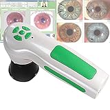 ♣【HD Bild】Hochauflösender Sensor, kann den Irisstatus genau und schnell anzeigen. Ausgestattet mit einem speziellen DSP-Bildprozessor und einem optischen Bildstabilisator, kann es Ihnen die bisher klarsten diagnostischen Iris-Farbbilder liefern.