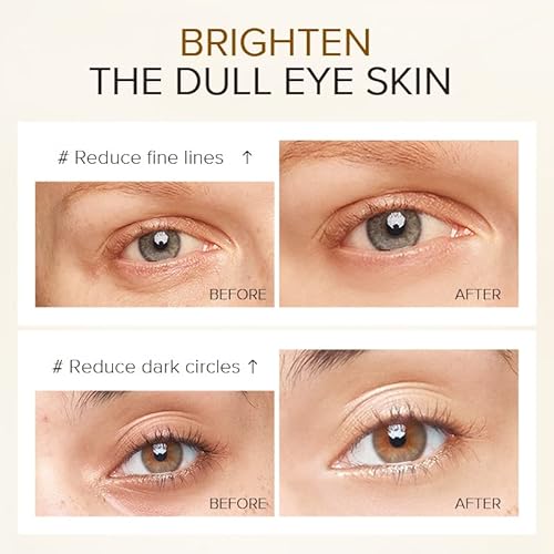 Akary 24K Gold Eye Serum, Under-Eye Firming Serum For Reduces Puffy Eyes, Dark Circles, Fine Lines, Under Eye Bags, Tightening, Hydrating Face Serum, Treatment For Skin Care With Nicotinamide And Vitamin E #TOP3