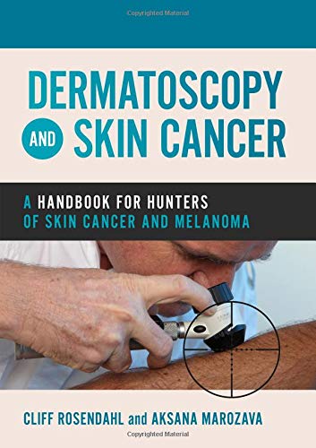 Dermatoscopy and Skin Cancer: A Handbook for Hunters of Skin Cancer and Melanoma