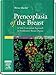 Produktbild Preneoplasia of the Breast: A New Conceptual Approach to Proliferative Breast Disease