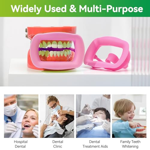 2 Stück Dental-Mundöffner, wiederverwendbar, autoklavierbar, Silikon, Zahnaufhellung, Wangenhalter, Lippenhalter für Zahnarzt, Mundinspektion, Mundschutz, Challenge-Spiel (Rosa)