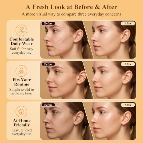 Cordless Red Light Face Mask 29.99 w/ Code + 67% Off Code QGNJTLGY - image 4