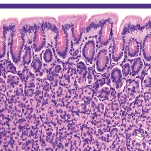 Facilitated reintroduction of eliminated eosinophilic esophagitis trigger foods with dupilumab