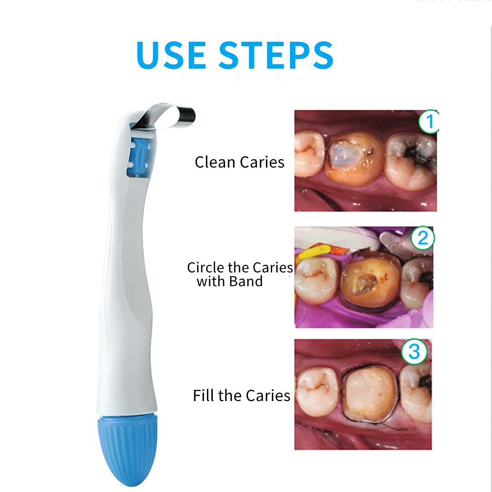 Dental Matrix Band, 50pcs Momar Restoration Matrix-Profecto Sectional Matrix Ring System Adjust (6MM-Standard)
