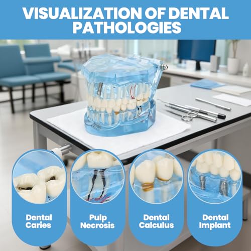 NSXAYIWE Zahnärztliches Oral-Typodont-Modell, Acryl-Blau-Zahnmodelle, Transparentes Mundmodell, Zahnmodell, Kompatibel Für Zahnmedizinisches Studium, Lehre, Forschung