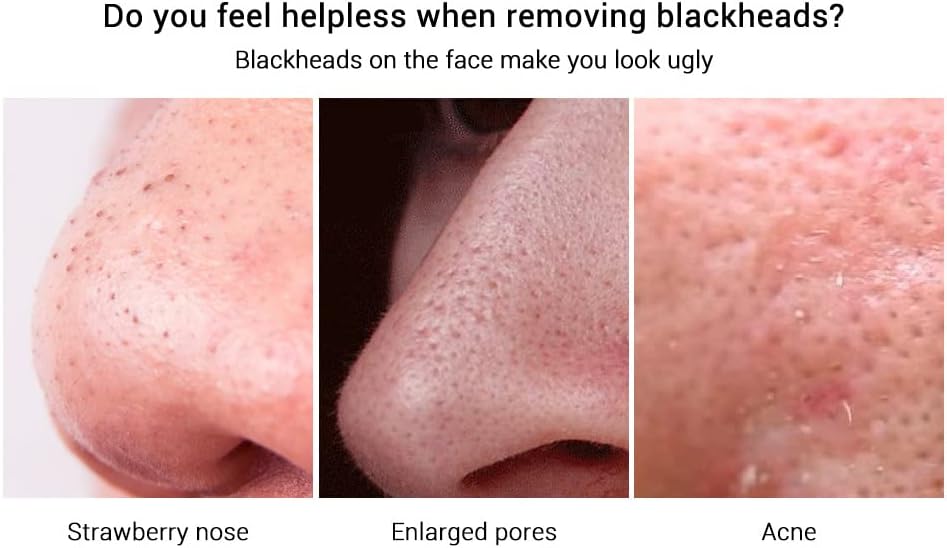 Blackhead Remover, Nose Plants Pore Strips,Deep Cleansing Nose Strips for Blackheads and Shrink Pores (1 PCS) : Beauty & Personal Care