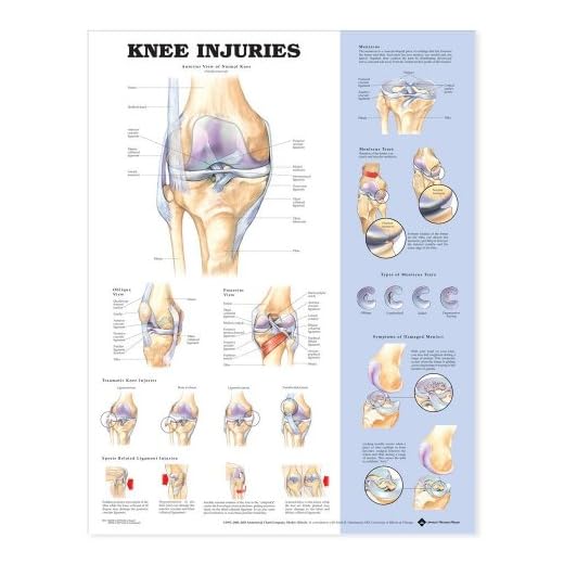 Anatomical Chart Company Lesiones de rodilla