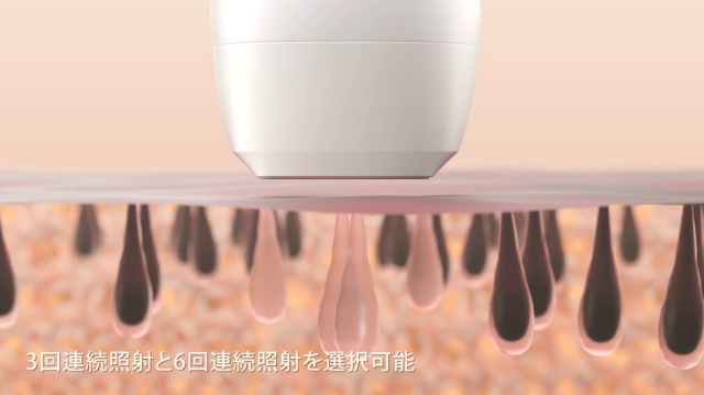 Toveo 脱毛器 フラッシュ式 IPL技術　家庭用脱毛器 Amazon | 脱毛器 フラッシュ式 IPL技術 光美容器 家庭用脱毛器