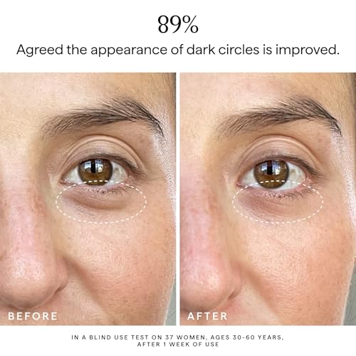 HERBIVORE Super Nova 5% THD Vitamin C + Caffeine Brightening Eye Cream | Targets Dark Circles & Puffiness | Vegan, Plant-Based, Cruelty-Free,15 mL / 0.5 oz