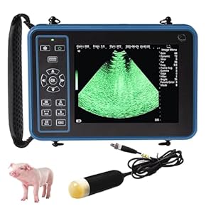 Amazon.co.jp: 超音波診断装置 - 診断・スクリーニング: 産業