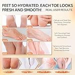 LANBENA Vitamin C Foot Peeling Mask, Foot Mask for Dry Cracked Feet, Exfoliator Peel Off Calluses Dead Skin Callus Remover, Repair Rough Heels & Get a Baby Soft Feet for Men and Women(2 Pairs) - Image 4