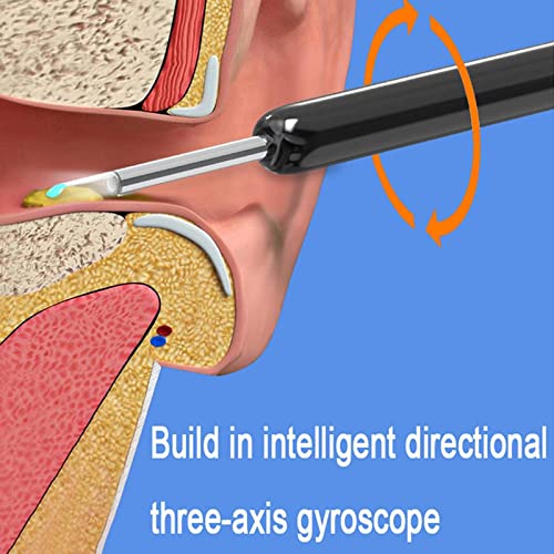 ZIRYXQ Caméra Oreilles Nettoyage Wi-Fi Visible Cire Élimination Cuillère Usb 1080p HD Wi Load Spoon Elimination Wax Visible Otoscope – vue 6