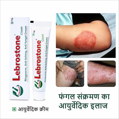 Image of Cream 15g - Ayurvedic Treatment for Ringworm, Anti Itching, & Anti Fungal Infections (15 (Gram) Pack of 6, 90, gram)