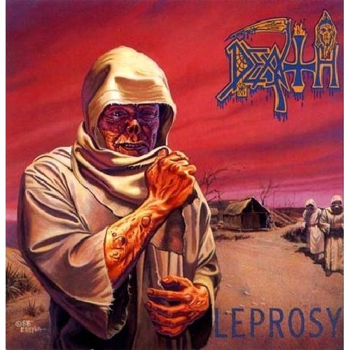 Leprosy