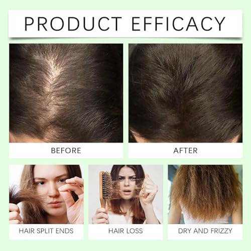 Image of Anti Hair Loss Shampoo,Remimpi Anti Hair Fall,Promote Hair Growth and Thickening & Strengthening Shampoo with Various Plant Extracts for All Hair Types (1PCS)