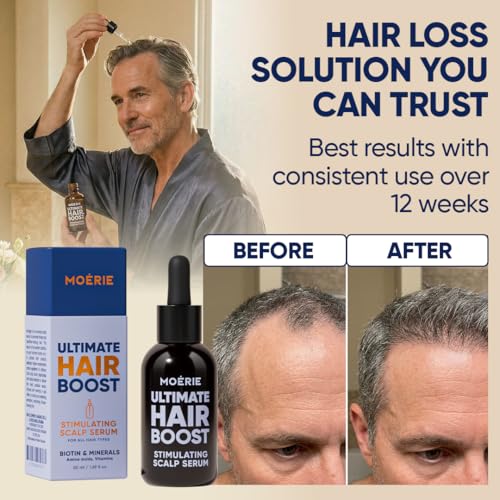 MOERIE Ultimate Hair Growth Serum 50ml — Caffeine + Biotin Scalp Serum — view 5