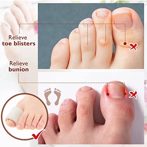 Image of Tondiamo 6 Pcs Foam Toe Sleeves Protector Cuttable Tube, Large, Beige | Foam Bandages Cuttable Tube Toe Cushion Covers, Foot Protection for Feet, Bunion, Hammer, Callus Corn, Bliste, Pain