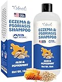 Eczema Shampoo – All-Natural Dermatitis & Psoriasis Treatment for Dry, Itchy, Flaky Skin – Daily Dandruff & Scalp Treatment – Itchy Scalp Relief for Men, Women & Kids – Eczema Soap Shampoo Made in USA