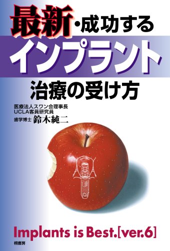 PDFダウンロード 最新・成功するインプラント治療の受け方 バイ