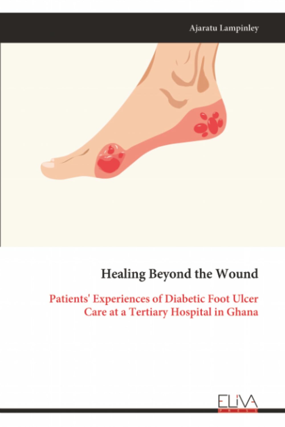Healing Beyond the Wound: Patients' Experiences of Diabetic Foot Ulcer Care at a Tertiary Hospital in Ghana