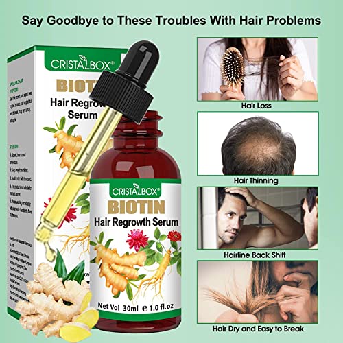 5 Pack Ginger Oil For Hair Growth,Hair Growth Serum,Biotin Hair Growth Oil,Hair Growth Ginger Serum For Men And Women,Hair Growth Treatment,Hair Loss Treatment,Promotes Thicker,Growth Hair #TOP6