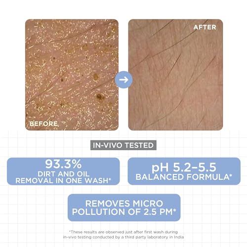 Image of SKINQ Niacinamide Face Wash | Gentle Daily Cleanser with Evening Primrose Oil & Glycerin | pH Balanced 5.2-5.5 | Dirt & Oil Removal in 1 Wash | No SLS, No Parabens | For Normal, Dry & Sensitive Skin | 50ml