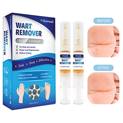 Samsali Wart Remover, Maximum Strength, Easy and Painless Wart Remover, Removing all Kinds of Common Warts, Best Wart Remover for Removing Warts