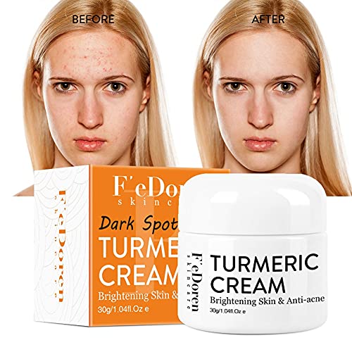 Luxsea Turmeric Face Cream Repair Acnes Scar Dark Spot Treatment Moisturizer Acne Scar Remover Cream for Face, Balance Water and Oil, Perfect for Acne Scar Removal