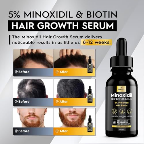 Image of 5% Minoxidil Hair Growth Serum for Men & Women, Beard Growth Oil 1oz 6pcs