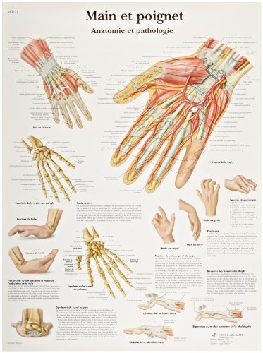 Image of 3B Scientific VR2171UU Glossy Paper Main Et Poignet Anatomie Et Pathologie Chart (Hand and Wrist Anatomy and Pathology Chart, French), Poster Size 20 inch Width x 26 inch Height