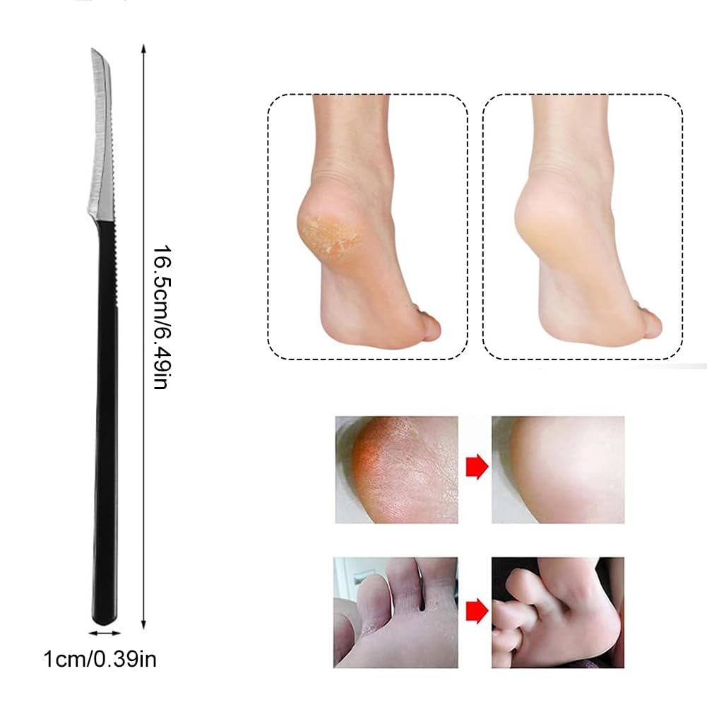 Cuchillo de Pedicura, Removedor de Callos Para Pies, Lima de Pie de Maíz de Piel, Cuchillo de Pedicura, Lima de Pie Raspador de Callos, Raspador Removedor de Callos de La Piel, Raspador de Pedicura
