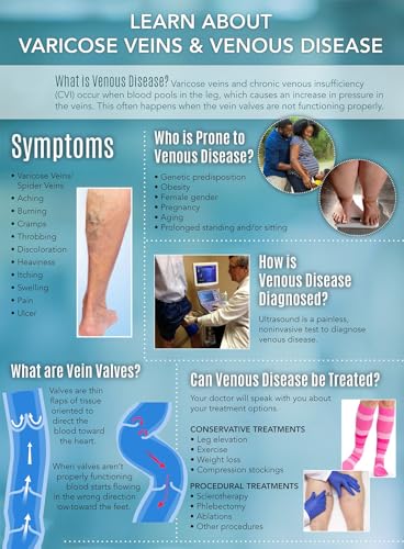 Stages of Varicose Veins Hospital Poster Varicose Veins Stages Treatment