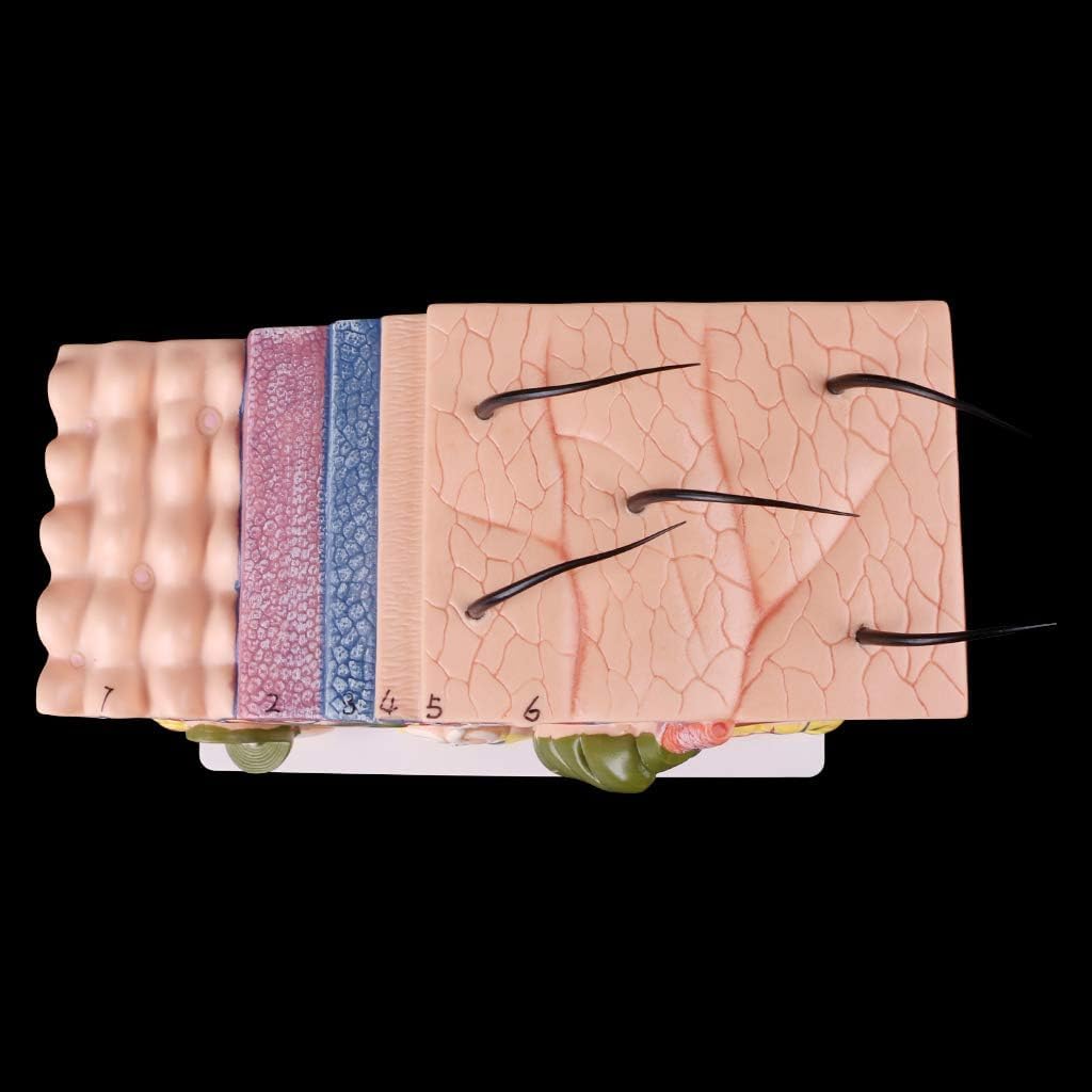 ハローキティ【夏限定 】スイカ 日焼け 2002年 激レア根付 ハロー