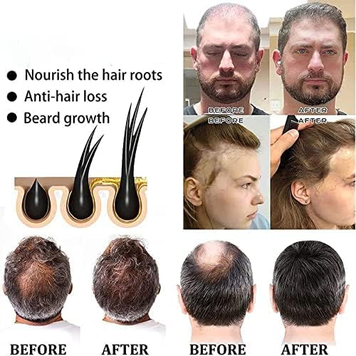 Miniatura 4 de Black & Thick Hair Fallopia Multiflora Shampoo Bar, He Shou Wu Shampoo Jabón, He Shou Wu Extract Champú, limpia profundamente el cabello y el cuero