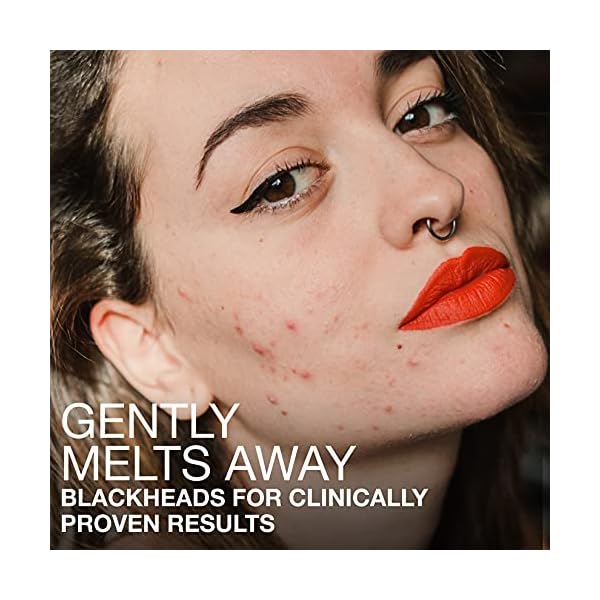 Neutrogena-Stubborn-Blackheads-Daily-Acne-Facial-Serum-with-Salicylic-Glycolic-Polyhydroxy-Mandelic-Acids-Oil-Free-Face-Serum-for-Acne-Prone-Skin-to-Help-Clear-Clogged-Pores-1-fl-oz Neutrogena Stubborn Blackheads Daily Acne Facial Serum with Salicylic, Glycolic, Polyhydroxy & Mandelic Acids, Oil-Free Face Serum for Acne-Prone Skin to Help Clear Clogged Pores, 1 fl. oz