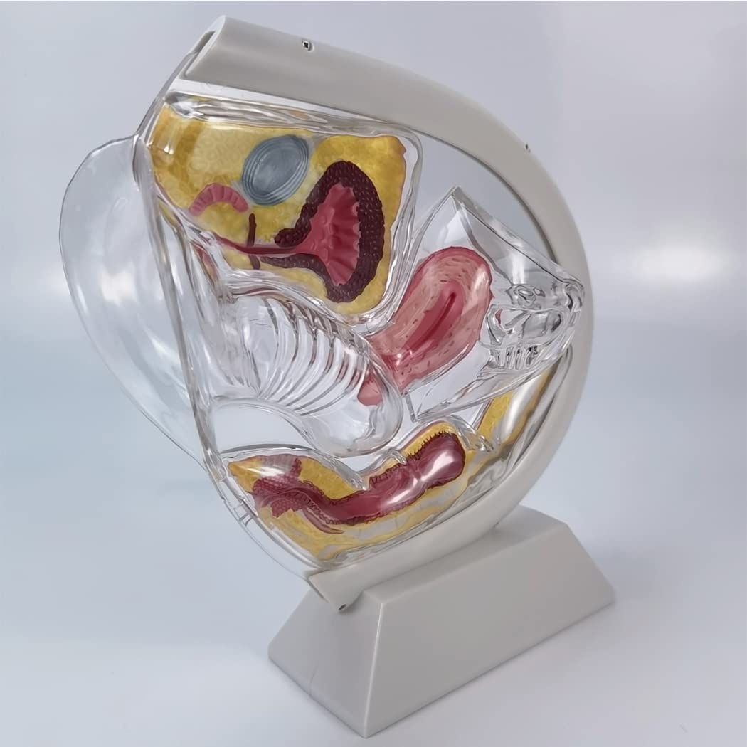 Transparentes Uterus-Modell Demonstration des Menstruationstassen-Verhütungslehrmodells Fortpflanzungsorgan Anatomisches Modell des Uterinen Fortpflanzungssystems des Becken-Eierstocks